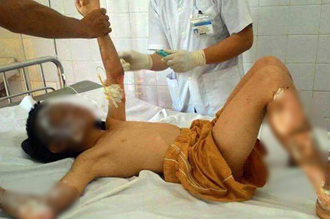 Nổ khí gas ở Lào Cai, 10 người bị thương