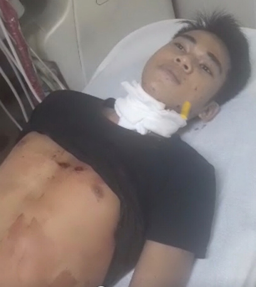 Ghen tuông mù quáng, sát hại người tình rồi tự sát